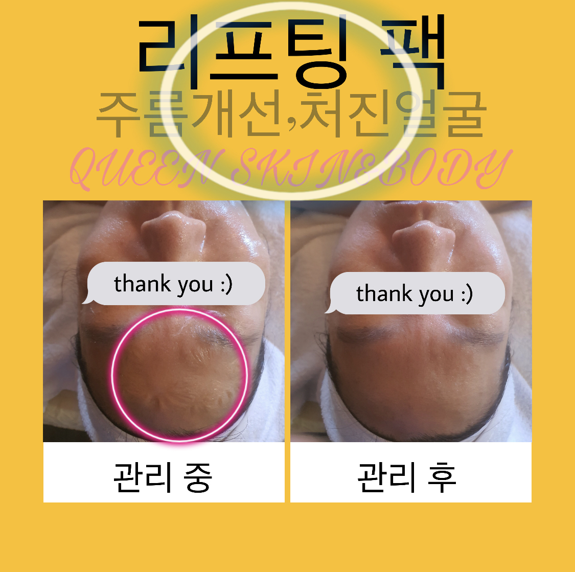 창원 성주동 <퀸스킨앤바디> 피부관리사 경력직 구인해요 #1